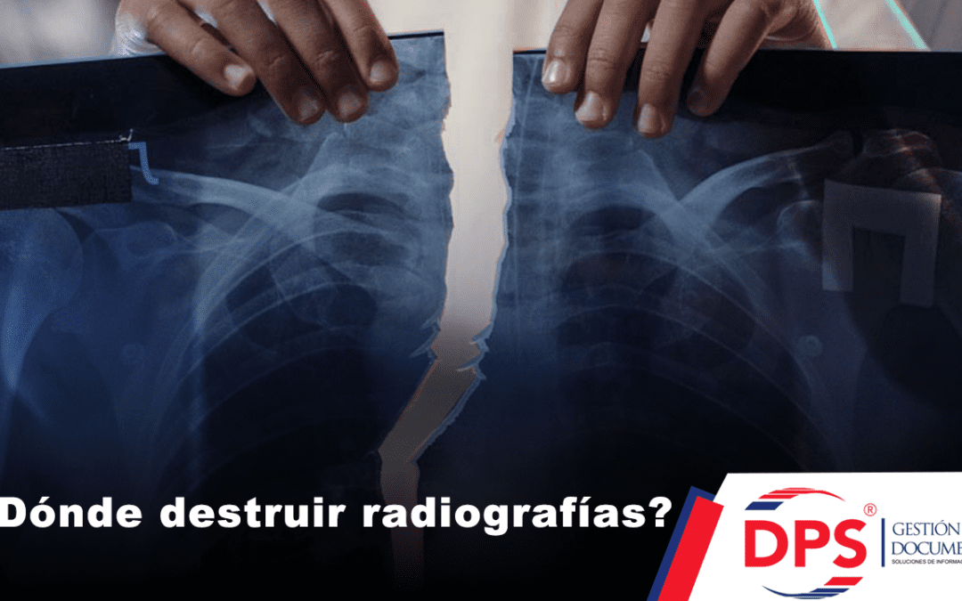 ¿Dónde destruir Radiografías?